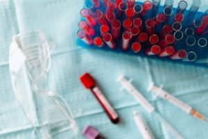 Overhead shot of blood samples, syringes, and safety goggles in a medical lab setting.